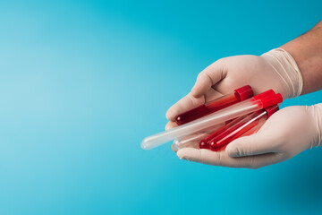 Cropped view of doctor in latex gloves holding throat swabs and blood samples on blue background.