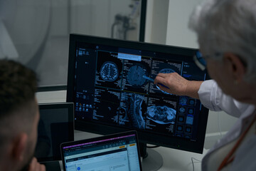 Elderly female doctor and her colleague reviewing brain CT scan results