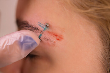 Professional placing the jewel of piercing on the temple on the head with ball. Tragus type.