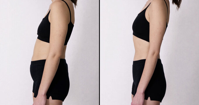 Woman Before And After Weight Loss