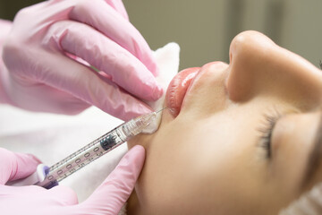 Lip augmentation and correction procedure in a cosmetology salon. The specialist makes an injection in the patient lips.