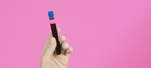 The hand is holding blood test tubes on pink background. Hand wears a white medical glove..