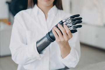 Handicapped young woman is assembling bionic arm with hand. Girl is adjusting prosthesis.