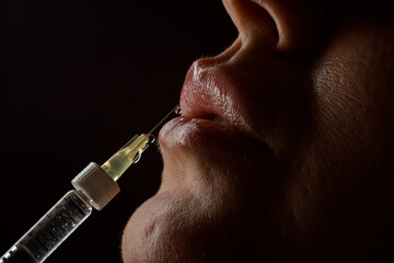side view of syringe needle with drop of the drug near the female lips. Botox injection.