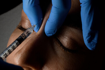 Close-up process of cosmetic botox injection in female face. Facial treatment and beauty injection...