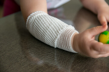 Wypadek małego dziecka. Opatrunek prawej ręki. Bandaż. Gips. - obrazy, fototapety, plakaty