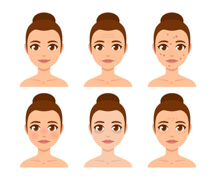 Skincare and skin concerns woman face set
