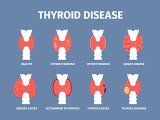 Thyroid gland various diseases. Goiter and hyperthyroid, inflammation trachea icons. Endocrinology disease, cancer and thyroiditis, recent vector set
