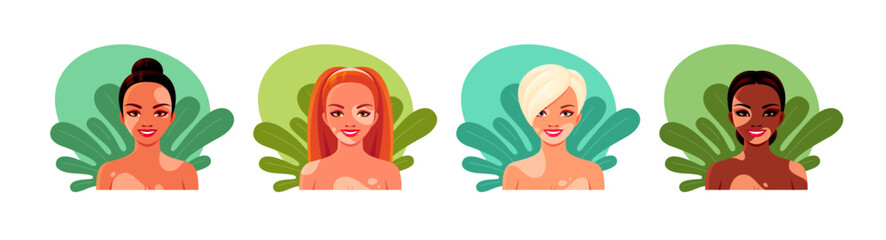 Portraits of young women with vitiligo. Diverse female characters with skin losing pigment. Vector cartoon avatar set of happy girls with depigmentation patches on body on leaves background