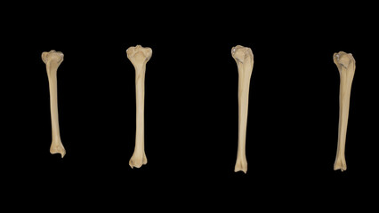 Right Tibia-Multiple Views
