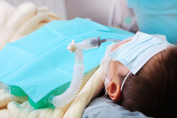 Little boy is under general anesthesia. A breathing tube in the baby's mouth. Surgical...
