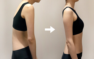 Posture correction of woman's rounded shoulders