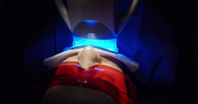 Teeth whitening at the dentist's office. Teeth whitening procedure with ultraviolet light UV lamp in a modern clinic. Whitening light bleaching woman teeth. Cosmetic dentistry center service.