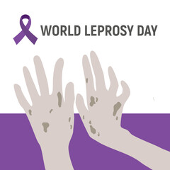 World Leprosy Day with hand and purple ribbon