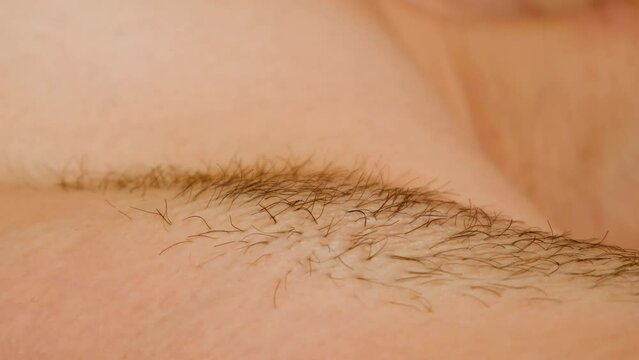 Sugaring, sugar waxing, or Persian waxing. Close up cosmetic procedure.