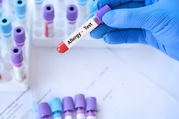 Doctor holding a test blood sample tube positive with allergy test on the background of medical...