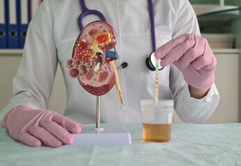 Artificial model of kidney and ureter and urinalysis