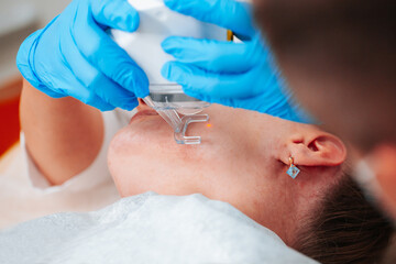 Doctor cosmetologist performs the procedure of laser skin resurfacing and scar removal with modern...