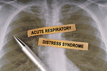 On a human chest x-ray, a pen and strips of paper labeled - Acute respiratory distress syndrome