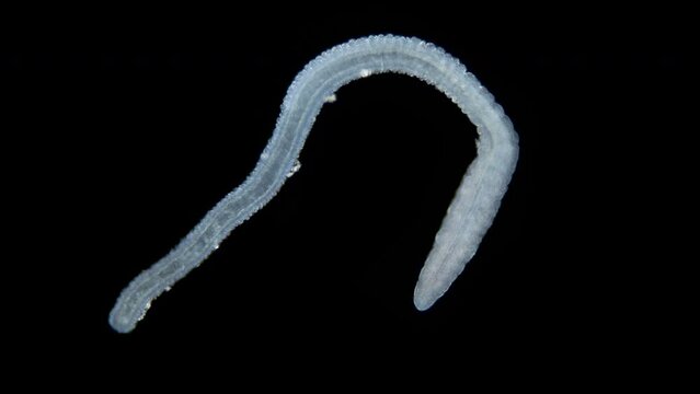 A wriggling tentacle similar to a worm under a microscope. Possibly from Polychaeta, family Terebellidae. Sample Found in the White Sea