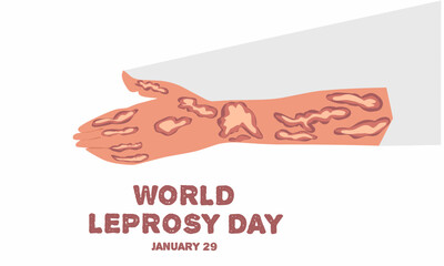 Vector graphic of world leprosy day for world leprosy day celebration. flat design. flyer design. January 29