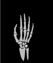 X-ray of the hand