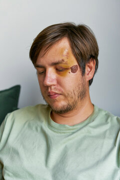 thoughtful man with a head injury