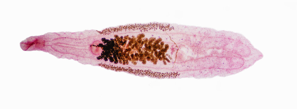 Clonorchis sinensis adults micrograph
