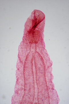 Clonorchis sinensis adults micrograph