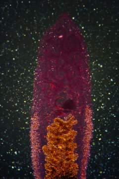 Clonorchis sinensis adults micrograph