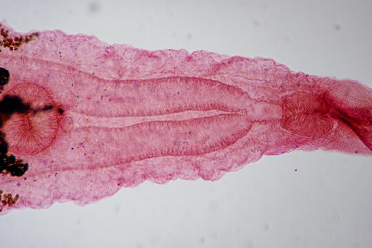 Clonorchis sinensis adults micrograph