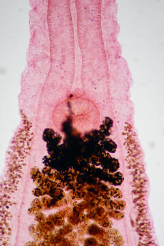 uterus of Clonorchis sinensis adults micrograph