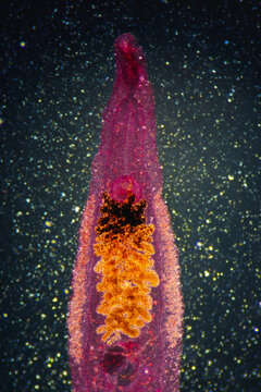 Clonorchis sinensis adults micrograph