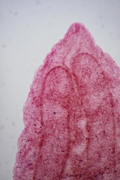 Clonorchis sinensis adults micrograph