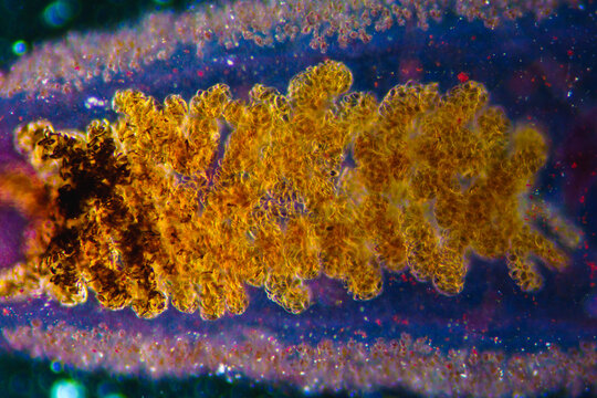 uterus of Clonorchis sinensis adults micrograph