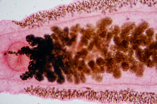uterus of Clonorchis sinensis adults micrograph