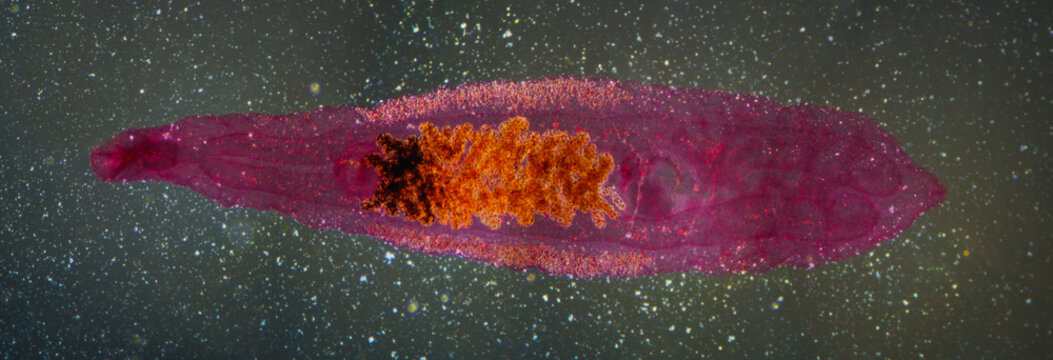 Clonorchis sinensis adults micrograph