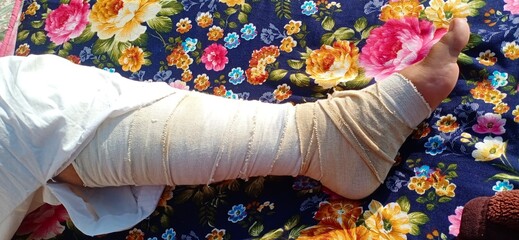 Flower in backgroung injury on leg