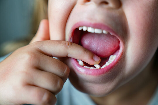 Child Touching Loose Baby Tooth