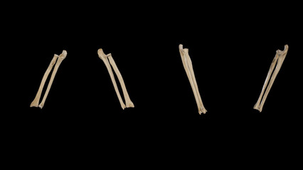 Bones of Forearm-Multiple Views