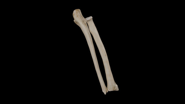 Posterior view of Right Forearm Bones