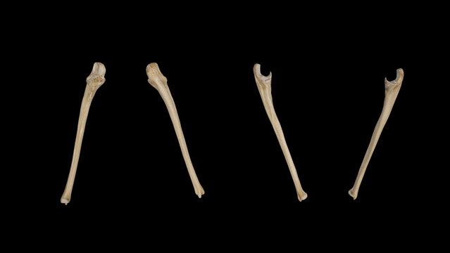 Right Ulna-Multiple Views