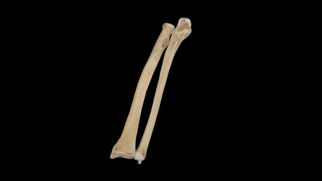 Anterior view of Right Forearm Bones