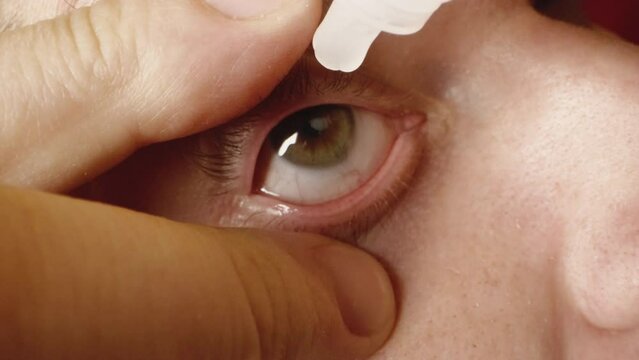 Person tries to apply hydrating drops after fitting contact lenses. Man opens up eye wide with fingers moving iris to sides extreme closeup