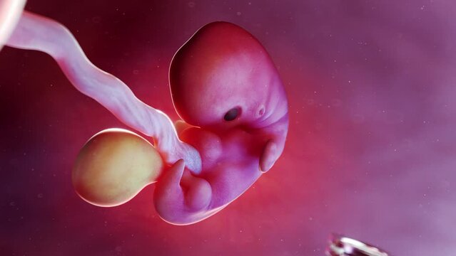 3D rendered medical animation of an abortion