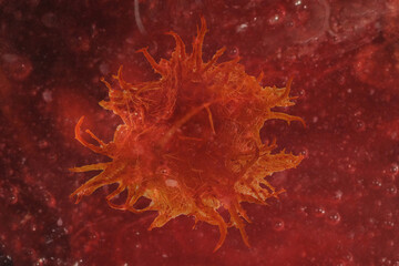 Magnification of a carcinoma cell