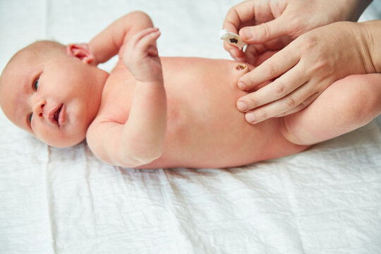 Mom treats the umbilical wound to a newborn baby.