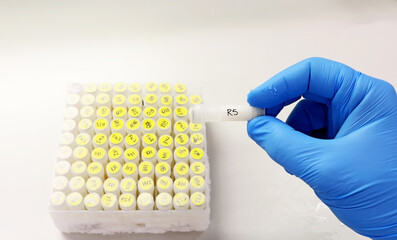 Scientist's hand with blue gloves taking frozen clinical samples