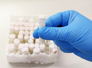 Scientist's hand with blue gloves taking frozen clinical samples