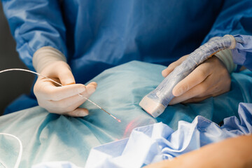 Endovenous laser coagulation for treatment varicose veins and ultrasound machine. Vascular surgeon...
